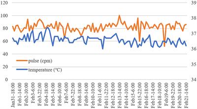 Shedding of SARS-CoV-2 for 85 Days in COVID-19 Patients With Type 2 Diabetes Mellitus and Lung Metastasis: A Case Report